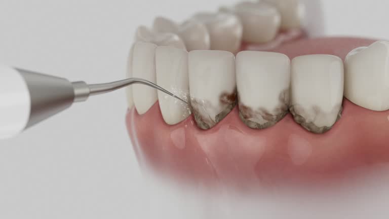Reliable Dental Implants contractor in Seville, FL by Smile Center Dentistry